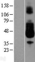 CD89 (FCAR) Human Over-expression Lysate