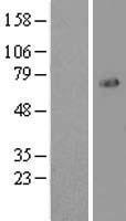 FOXO1 Human Over-expression Lysate