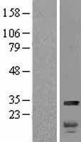 HMGB2 Human Over-expression Lysate