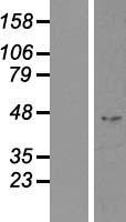 IHH Human Over-expression Lysate