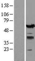 IRF5 Human Over-expression Lysate