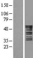 Cytokeratin 8 (KRT8) Human Over-expression Lysate