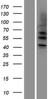 Cytokeratin 4 (KRT4) Human Over-expression Lysate