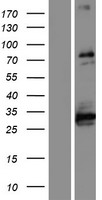 ABLIM1 Human Over-expression Lysate
