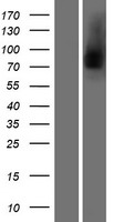 Lactoferrin (LTF) Human Over-expression Lysate