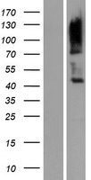 CD229 (LY9) Human Over-expression Lysate