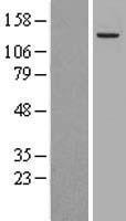 Mannosidase II (MAN2A1) Human Over-expression Lysate