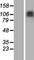 Matrilin 2 (MATN2) Human Over-expression Lysate