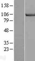 MCM3 Human Over-expression Lysate