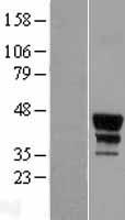 MEIS2 Human Over-expression Lysate