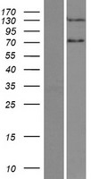 PPP2R3A Human Over-expression Lysate