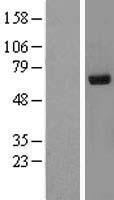 Ribophorin II (RPN2) Human Over-expression Lysate
