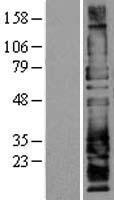 CD162 (SELPLG) Human Over-expression Lysate