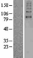SGLT2 (SLC5A2) Human Over-expression Lysate