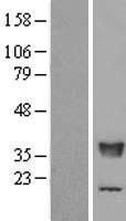 TFIIS (TCEA2) Human Over-expression Lysate