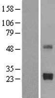 TIMP2 Human Over-expression Lysate
