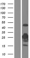 Thymidine Kinase 1 (TK1) Human Over-expression Lysate