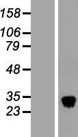 Tetranectin (CLEC3B) Human Over-expression Lysate