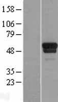 TSPYL1 Human Over-expression Lysate