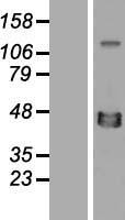 XRCC4 Human Over-expression Lysate