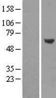 CORO2A Human Over-expression Lysate