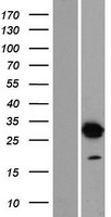 DNALI1 Human Over-expression Lysate