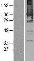 DGKZ Human Over-expression Lysate