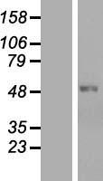 Carbohydrate sulfotransferase 1 (CHST1) Human Over-expression Lysate