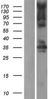 STK16 Human Over-expression Lysate
