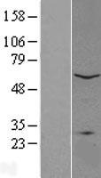 PLA2G4C Human Over-expression Lysate
