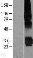 PPAP2C (PLPP2) Human Over-expression Lysate