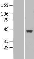 B3GALT4 Human Over-expression Lysate
