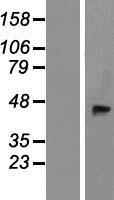 B4GALT3 (B4GALT2) Human Over-expression Lysate