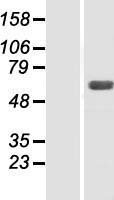 SNX4 Human Over-expression Lysate