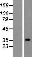 SUCLG1 Human Over-expression Lysate