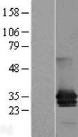 MPZL (MPZL1) Human Over-expression Lysate