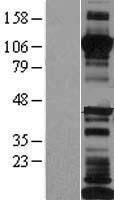 LI Cadherin (CDH17) Human Over-expression Lysate