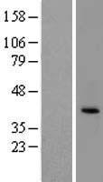 Ephrin B2 (EFNB2) Human Over-expression Lysate
