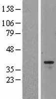 Aurora B (AURKB) Human Over-expression Lysate