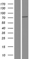 Transglutaminase 5 (TGM5) Human Over-expression Lysate