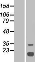 Acid Phosphatase (ACP1) Human Over-expression Lysate