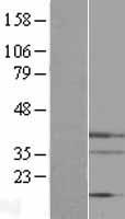 Endo G (ENDOG) Human Over-expression Lysate