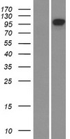 Eph receptor B4 (EPHB4) Human Over-expression Lysate