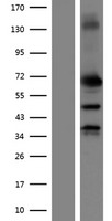 MMP2 Human Over-expression Lysate