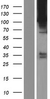 ROR2 Human Over-expression Lysate