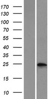 Phosphoserine phosphatase (PSPH) Human Over-expression Lysate