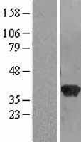 RABGGTB Human Over-expression Lysate