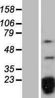 SNRPD2 Human Over-expression Lysate