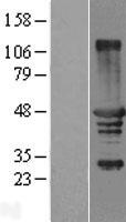 TCP10L3 Human Over-expression Lysate