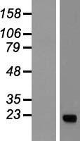 KRAS Human Over-expression Lysate